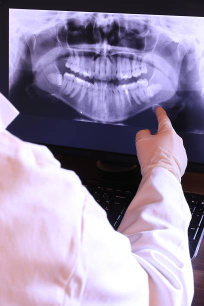 Best Knocked-Out Tooth Emergency  in Jackson, WI