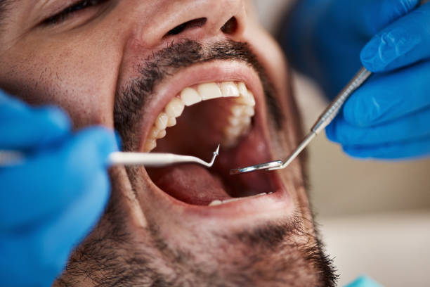 Best Root Canal Emergency Dentist  in Jackson, WI